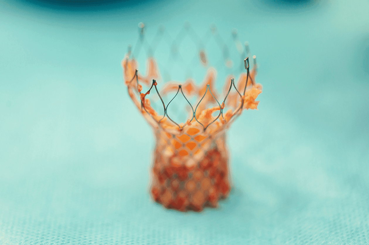 Aortic Valve Replacement: Indications and Treatment Choices