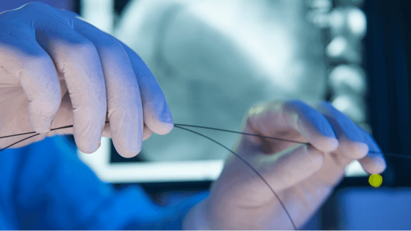 The Evolution of Interventional Cardiology: From Angioplasty to Modern Techniques